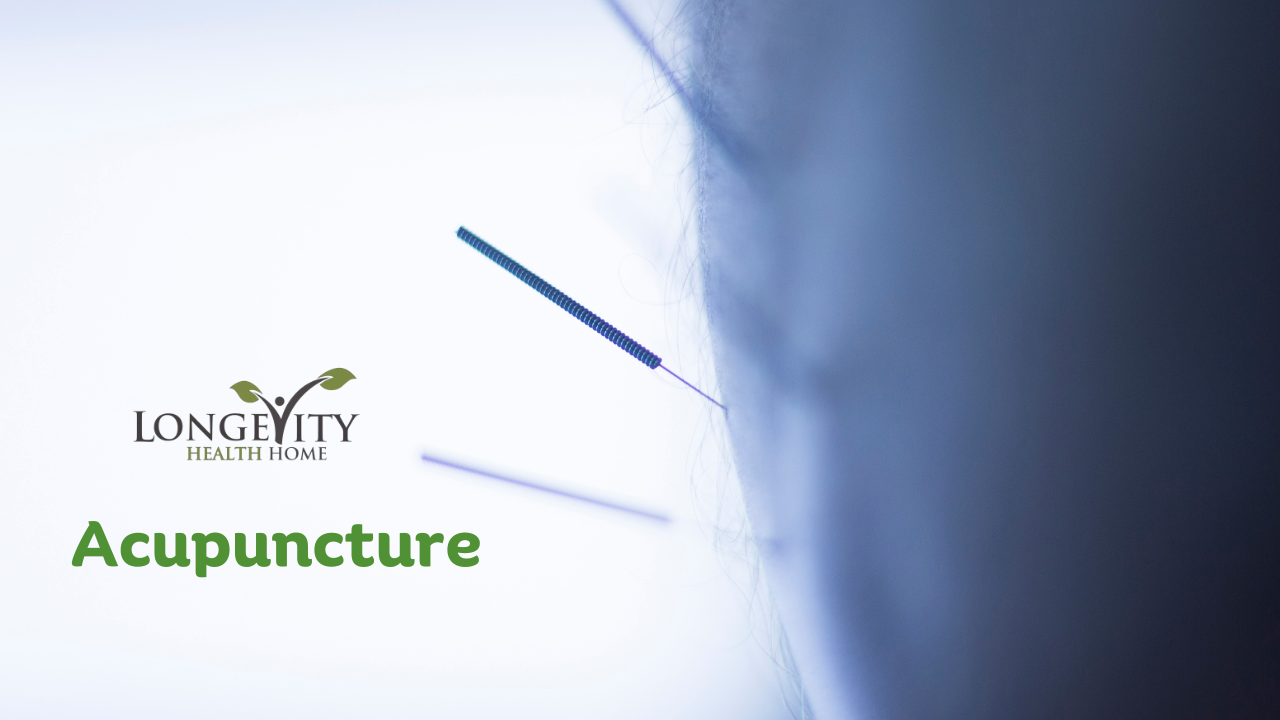 Acupuncture